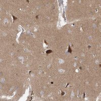 Anti-BRWD1 antibody produced in rabbit HPA030945-100UL