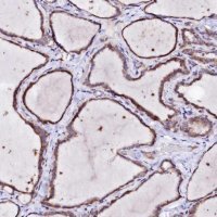 Anti-BTBD16 antibody produced in rabbit 