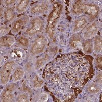 Anti-BTBD17 antibody produced in rabbit 