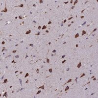 Anti-BTBD3 antibody produced in rabbit 