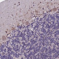 Anti-BTBD3 antibody produced in rabbit