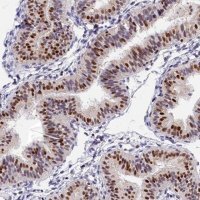 Anti-BTBD9 antibody produced in rabbit 