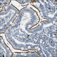Anti-BTG1 antibody produced in rabbit HPA005972-100UL