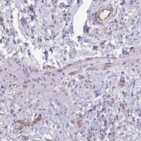 Anti-C10orf10 antibody produced in rabbit 