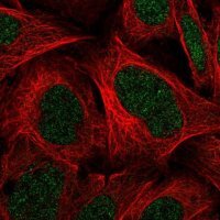 Anti-C11orf1 antibody produced in rabbit 