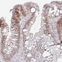 Anti-C11orf53 antibody produced in rabbit 