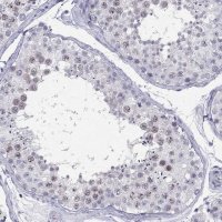 Anti-C11orf63 antibody produced in rabbit 