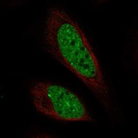 Anti-C11orf71 antibody produced in rabbit 