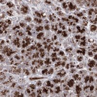 Anti-C11orf80 antibody produced in rabbit HPA038933-100UL