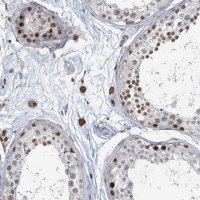 Anti-C11orf84 antibody produced in rabbit 