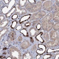 Anti-C11orf86 antibody produced in rabbit 