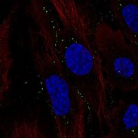 Anti-C11orf91 antibody produced in rabbit 