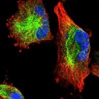 Anti-C11orf95 antibody produced in rabbit 