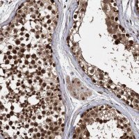 Anti-C12orf10 antibody produced in rabbit 