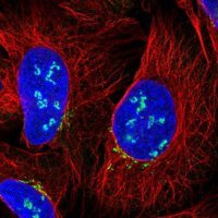 Anti-C12orf43 antibody produced in rabbit 