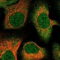Anti-C12orf60 antibody produced in rabbit 
