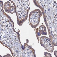 Anti-C12orf73 antibody produced in rabbit 