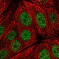 Anti-C14orf1 antibody produced in rabbit 
