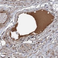 Anti-C14orf80 antibody produced in rabbit 