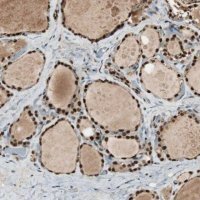 Anti-C14orf93 antibody produced in rabbit 