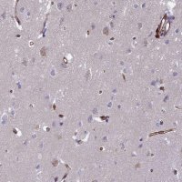 Anti-C15orf59 antibody produced in rabbit 