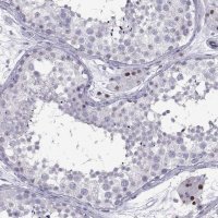 Anti-C16orf59 antibody produced in rabbit 