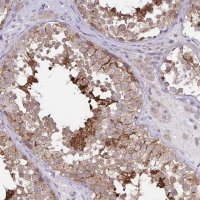 Anti-C17orf105 antibody produced in rabbit 