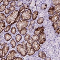 Anti-C17orf107 antibody produced in rabbit 