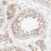 Anti-C17orf47 antibody produced in rabbit 