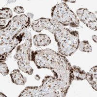 Anti-C17orf58 antibody produced in rabbit 