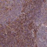 Anti-C17ORF62 antibody produced in rabbit 