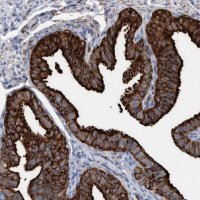 Anti-C17orf74 antibody produced in rabbit 