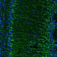 Anti-C17orf75 antibody produced in rabbit 