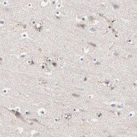 Anti-C17orf75 antibody produced in rabbit