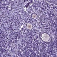 Anti-C18orf21 antibody produced in rabbit 