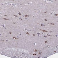 Anti-C19orf35 antibody produced in rabbit 