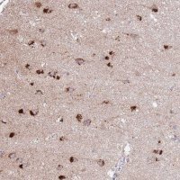 Anti-C19ORF71 antibody produced in rabbit HPA048654-100UL