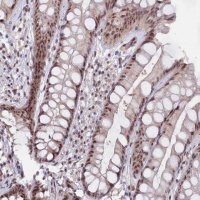 Anti-C1D antibody produced in rabbit 