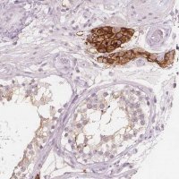 Anti-C1orf167 antibody produced in rabbit 