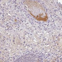 Anti-C1QB antibody produced in rabbit 