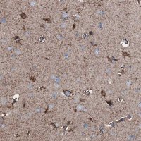 Anti-C1QTNF4 antibody produced in rabbit 