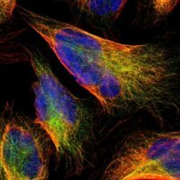 Anti-C1RL antibody produced in rabbit HPA011338-100UL