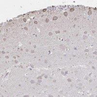Anti-C20orf24 antibody produced in rabbit 