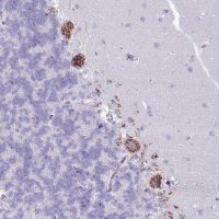 Anti-C20ORF96 antibody produced in rabbit 