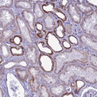 Anti-C21orf140 antibody produced in rabbit 