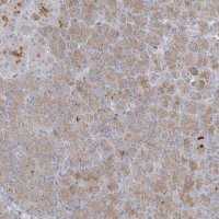 Anti-C21orf58 antibody produced in rabbit 