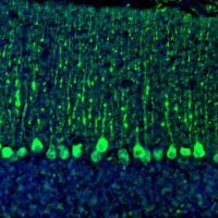 Anti-C21orf59 antibody produced in rabbit 