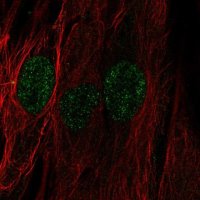 Anti-C22orf23 antibody produced in rabbit 
