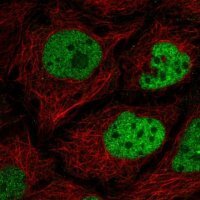 Anti-C2orf49 antibody produced in rabbit 