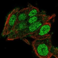 Anti-C2orf72 antibody produced in rabbit 